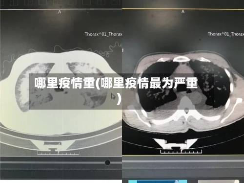 哪里疫情重(哪里疫情最为严重)-第2张图片